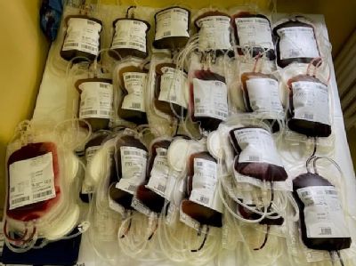 Nemocnica AGEL Zlaté Moravce bude odbery krvi organizovať dvakrát mesačne. Prvá dvadsiatka darcov už v roku 2022 najvzácnejšiu tekutinu darovala